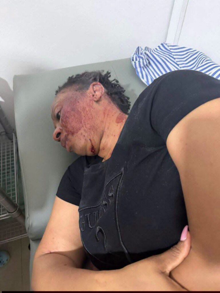 Former MP Sarah Adwoa Safo Reportedly Wounded in Shooting Incident 